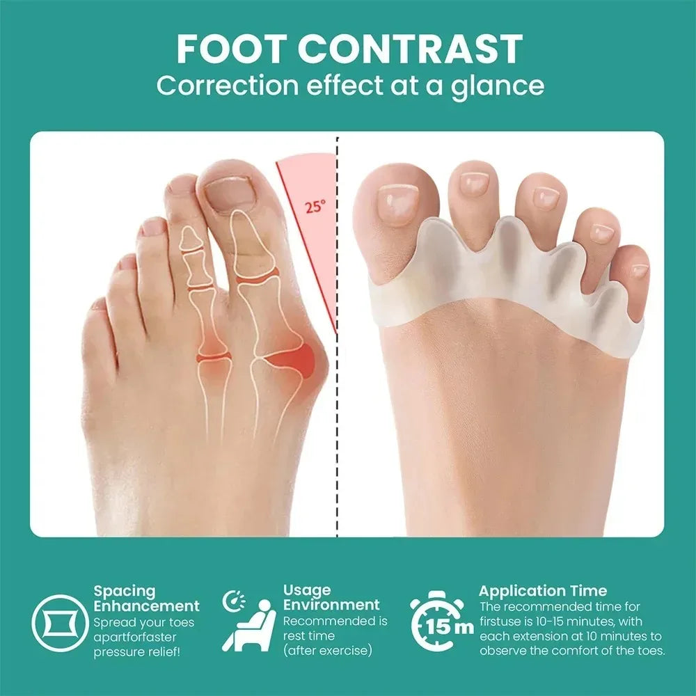 GentleFlex Silicone Toe Spacers – Soft Cushioned Comfort for Feet