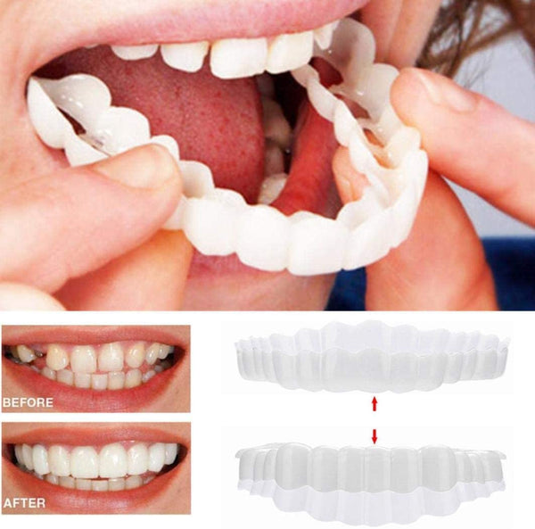 Natural Smile Enhancer | Customizable Veneers for Every Occasion
