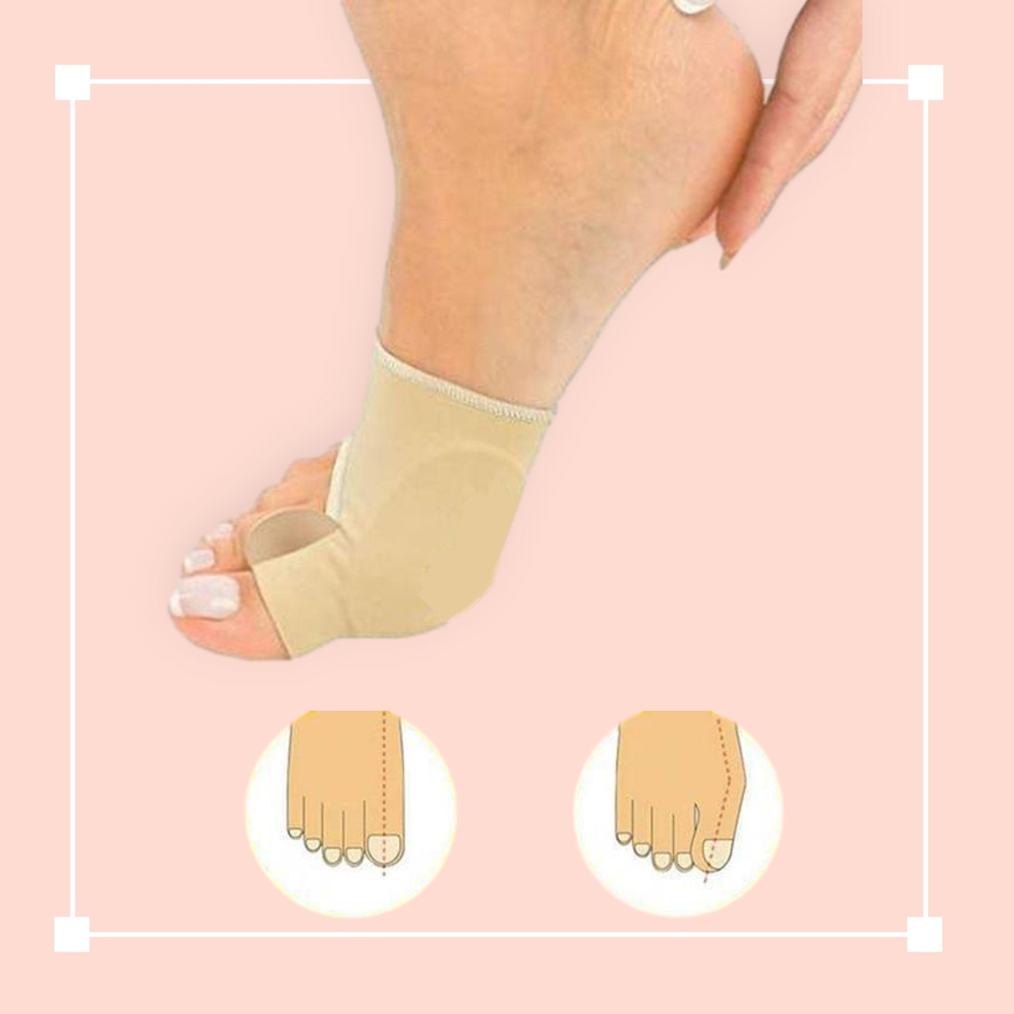 Revolutionary Toe Alignment Support Device