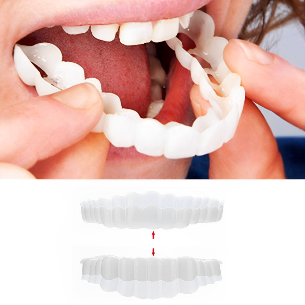 SmileSnap Clip-On Veneers – Effortless Cosmetic Teeth Cover for Instant Smile Boost