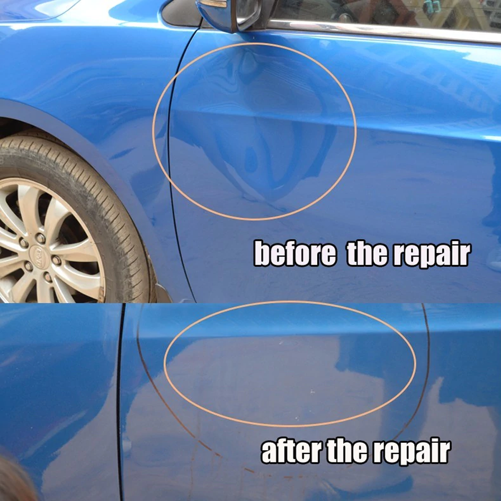 Ultimate Dent Repair Kit for Home and Vehicle