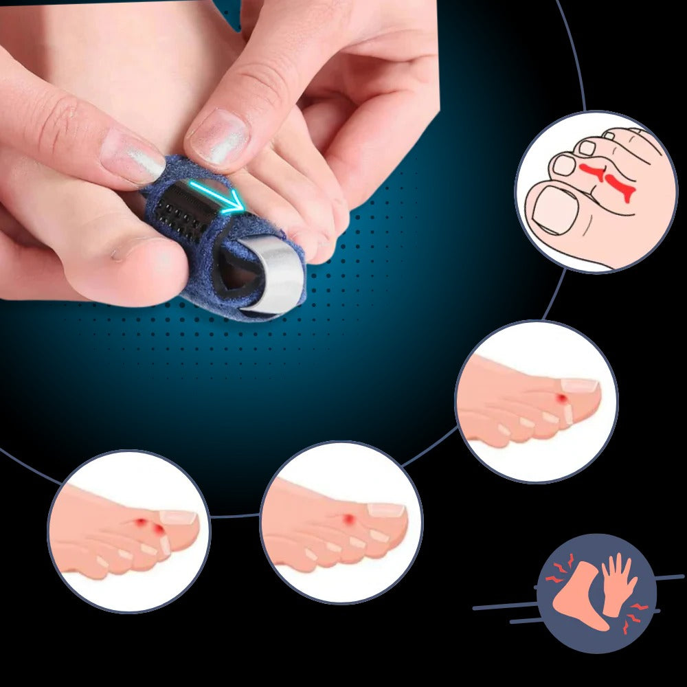 Adjustable Toe Alignment Support Device
