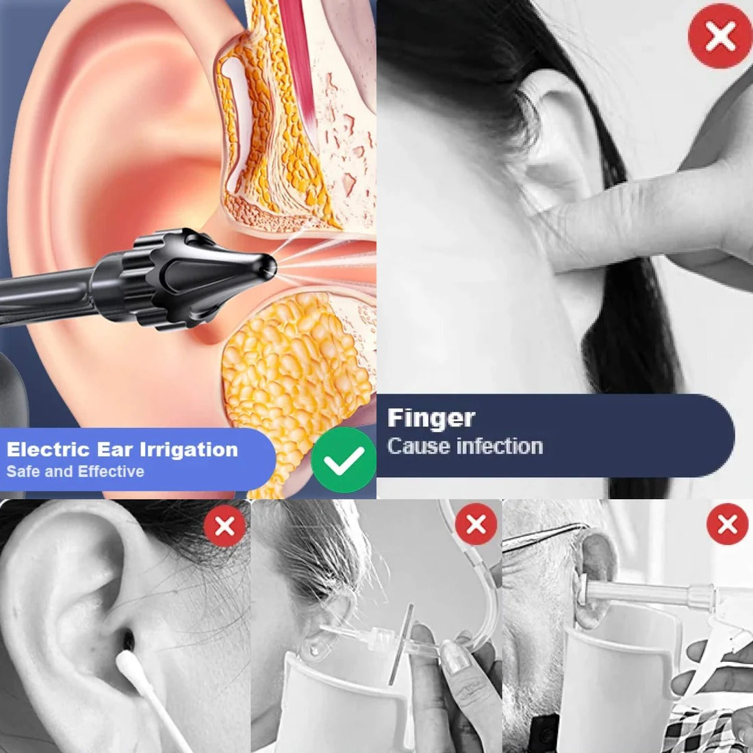 Advanced Earwax Removal Irrigation System