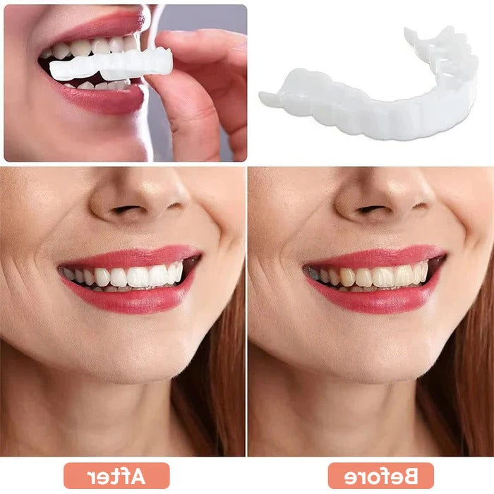 Transform Your Smile with Effortless Clip-On Veneers