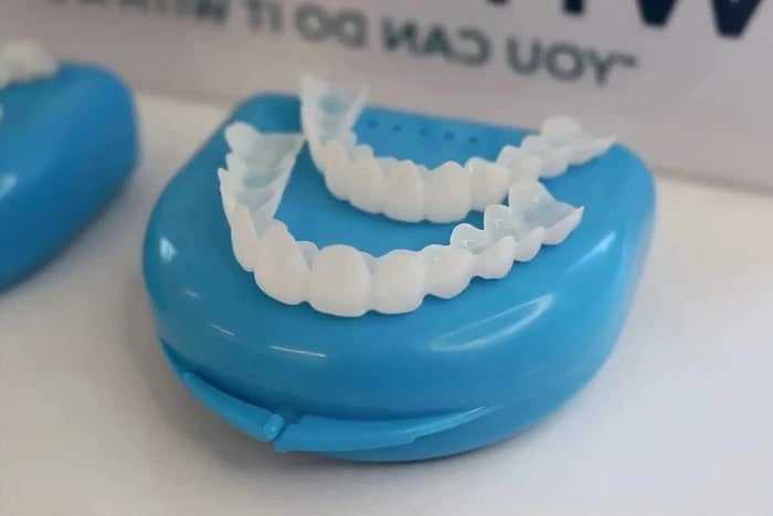Transform Your Smile with Effortless Clip-On Veneers