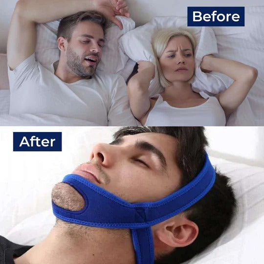 DreamGuard Sleep Chin Support Strap – Lightweight Adjustable Fit