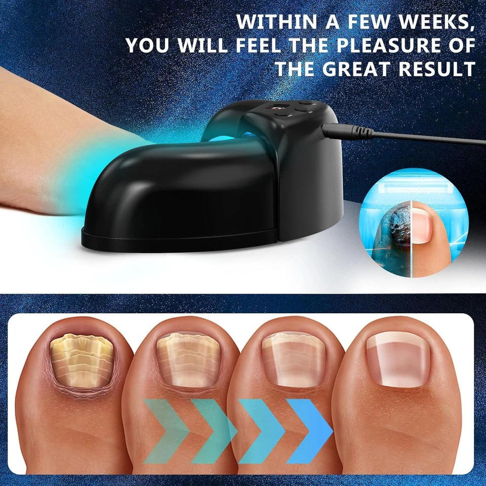 Nail Renewal Light Therapy System