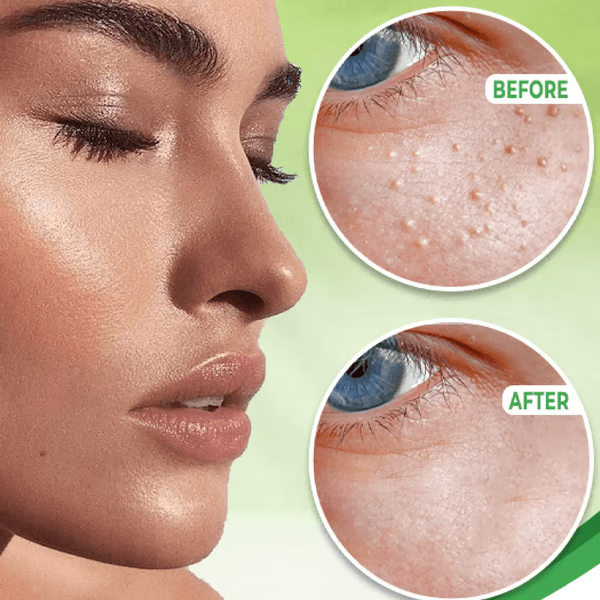 Revitalizing Eye Spot Treatment Cream