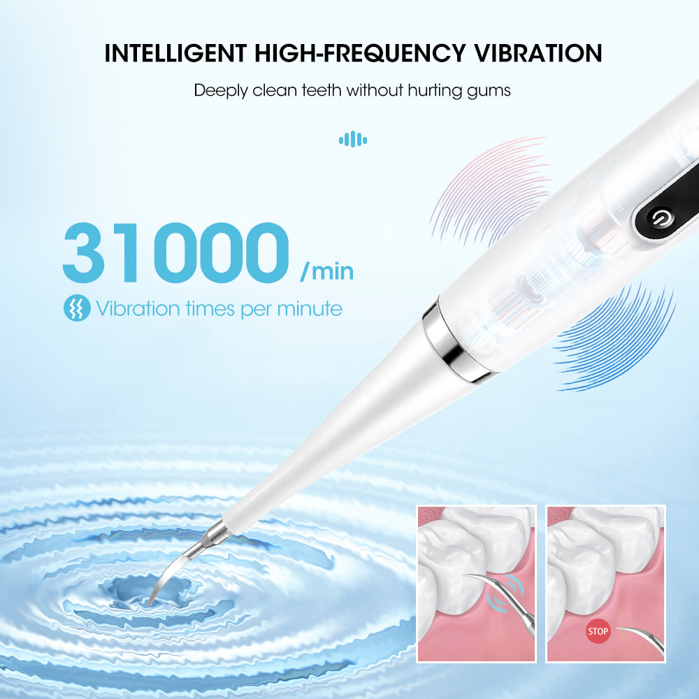 Professional Teeth Cleaning Device for Tartar Removal