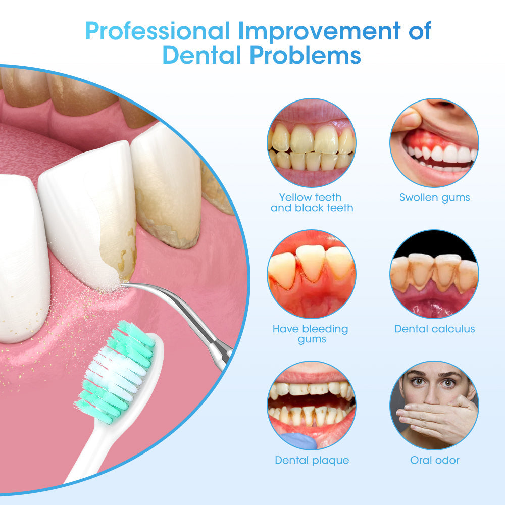 Professional Teeth Cleaning Device for Tartar Removal