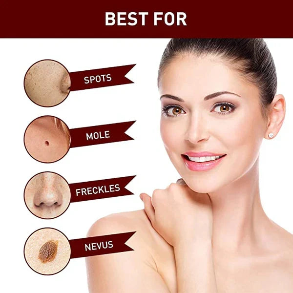 Skin Growth Eliminator for Home Use