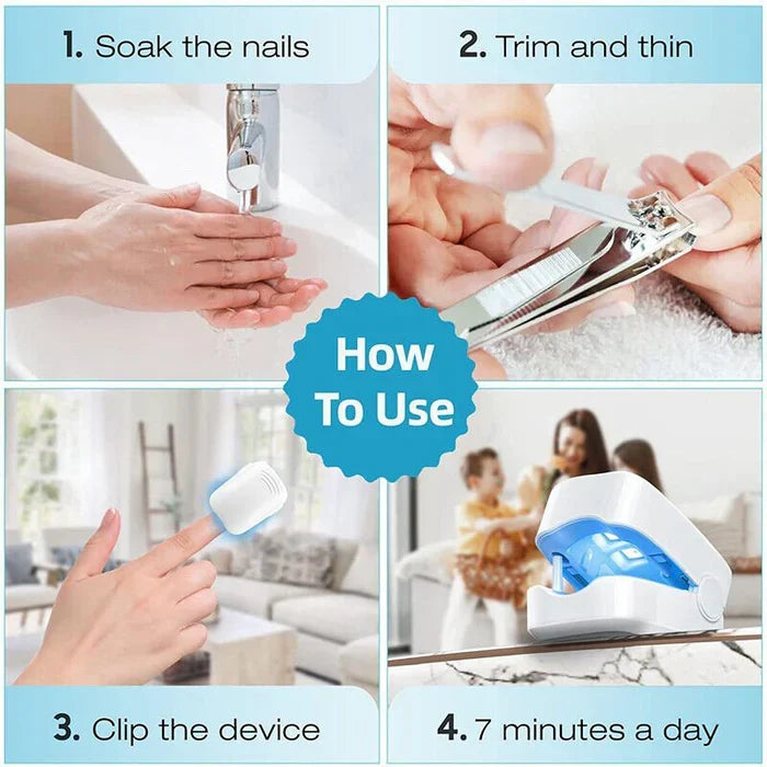 Laser Nail Care Solution - Effective Light Therapy for Fungal Treatment