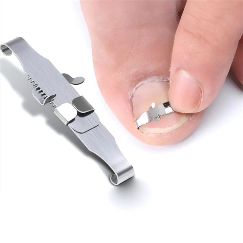 Precision Ingrown Toenail Fixer – Ultimate Foot Care Solution