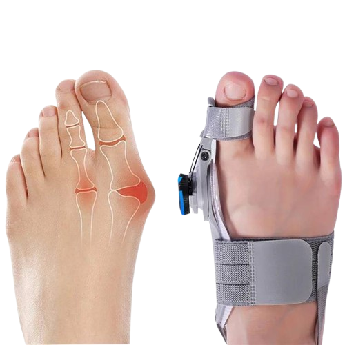 ComfortAlign Bunion Relief Toe Spacer