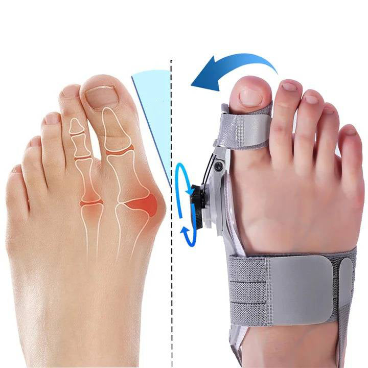 ComfortAlign Bunion Relief Toe Spacer