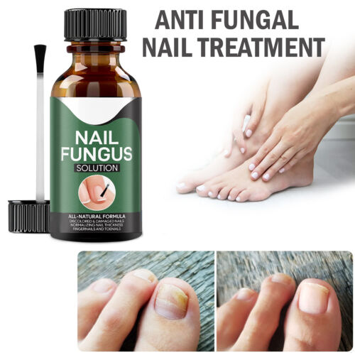 Nail Revival Essence: Banish Fungal Woes