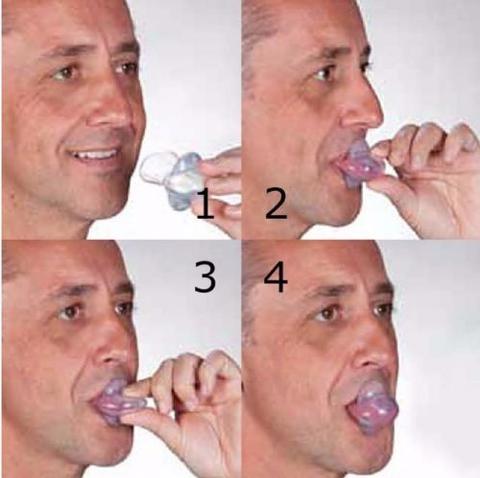 SnoreGuard Tongue Support Device