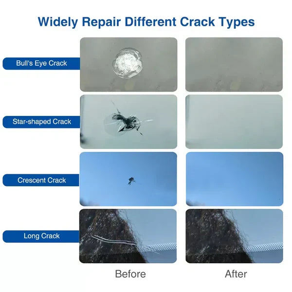 5-Pack DIY Windshield Repair Kit for Chips and Cracks