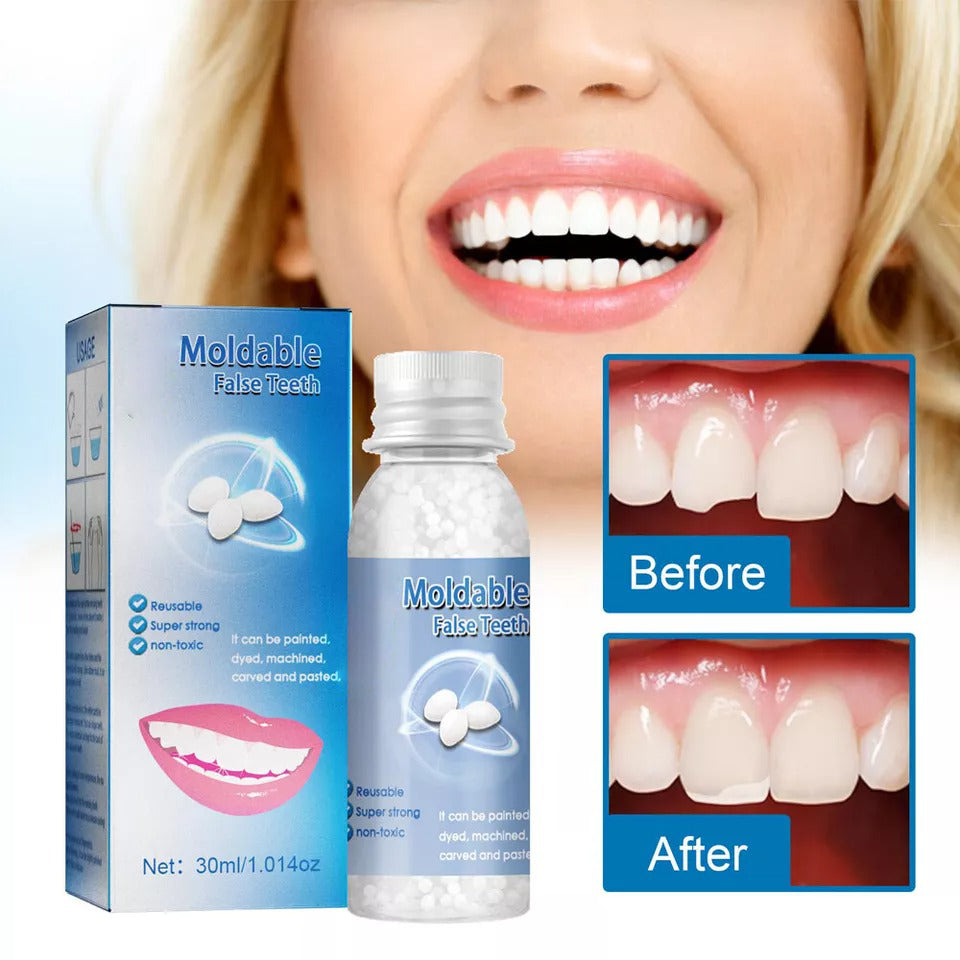 Custom Fit Dental Repair Kit for Missing Teeth